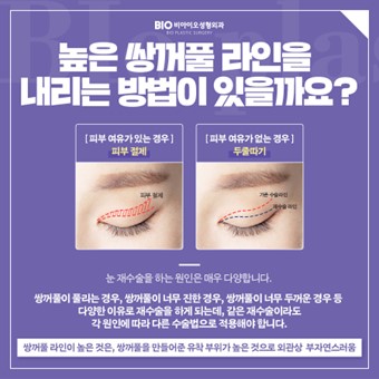 비아이오 이미지
