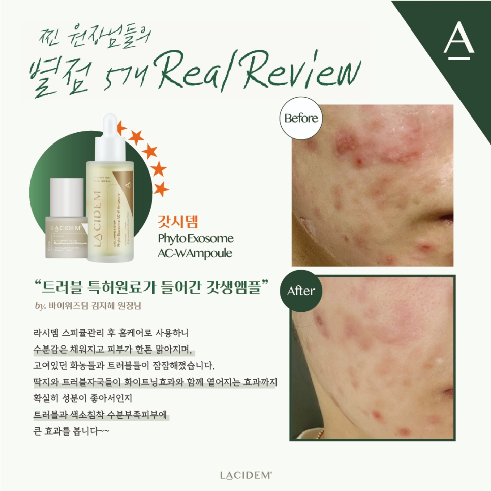 더블유에이씨 이미지
