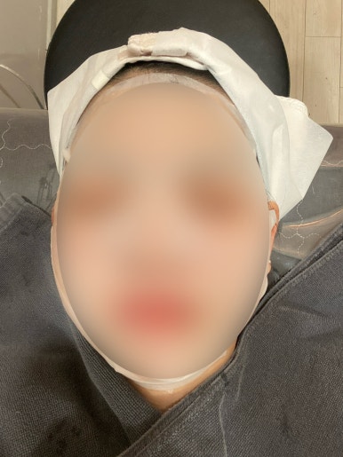 피코크린 이미지