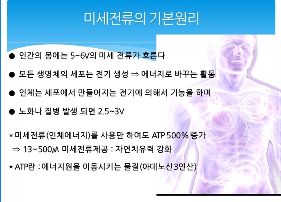 볼트 업 이미지