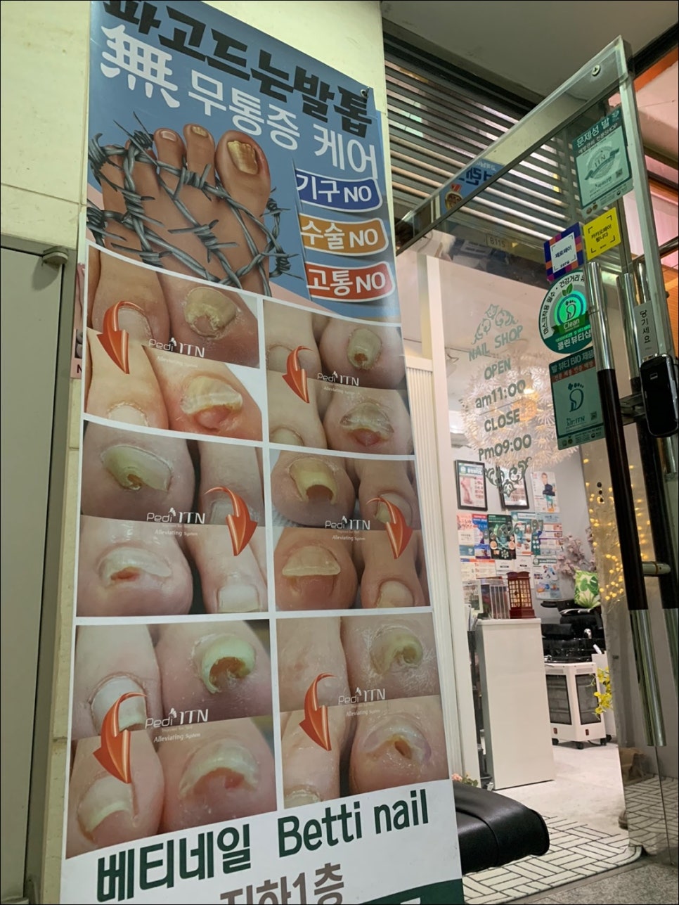 베티네일 이미지