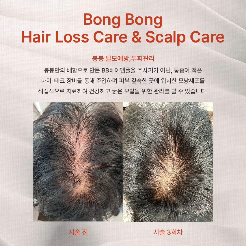 지지봉봉 이미지