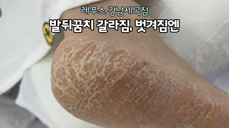 레푸스강남세곡점 이미지