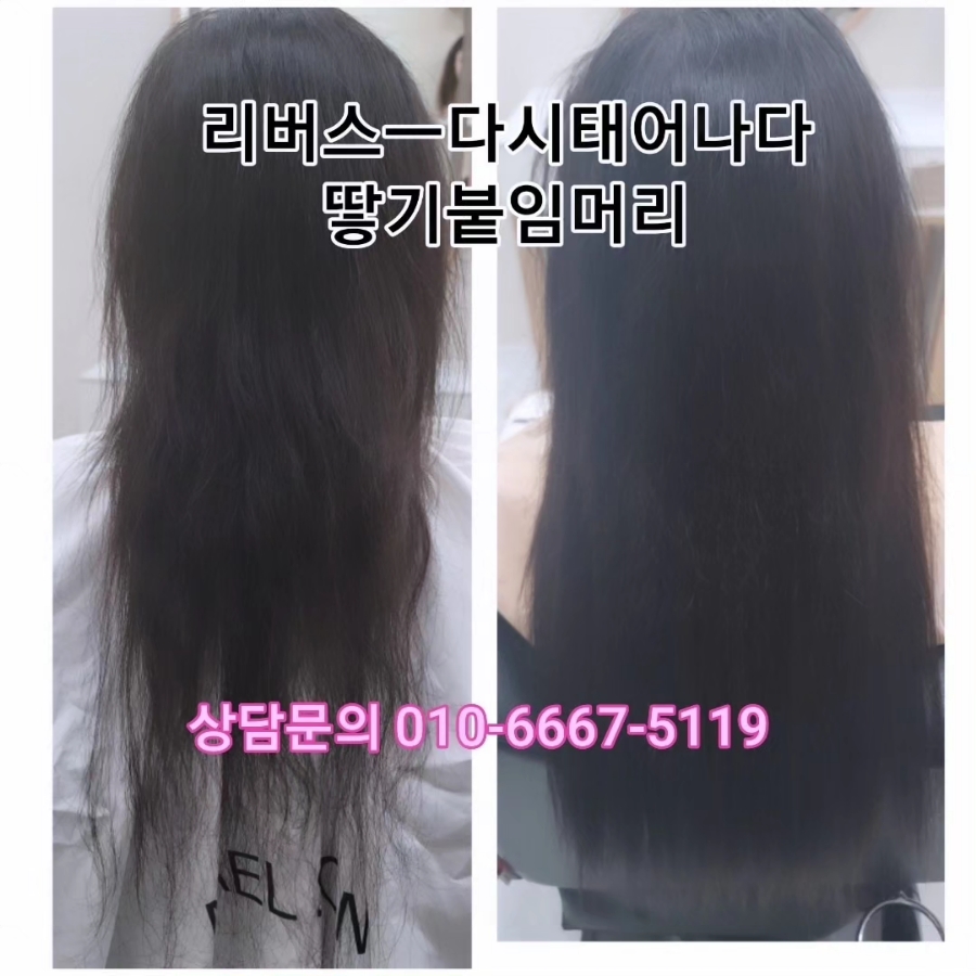 탈모응급실 리버스-다시태어나다 이미지