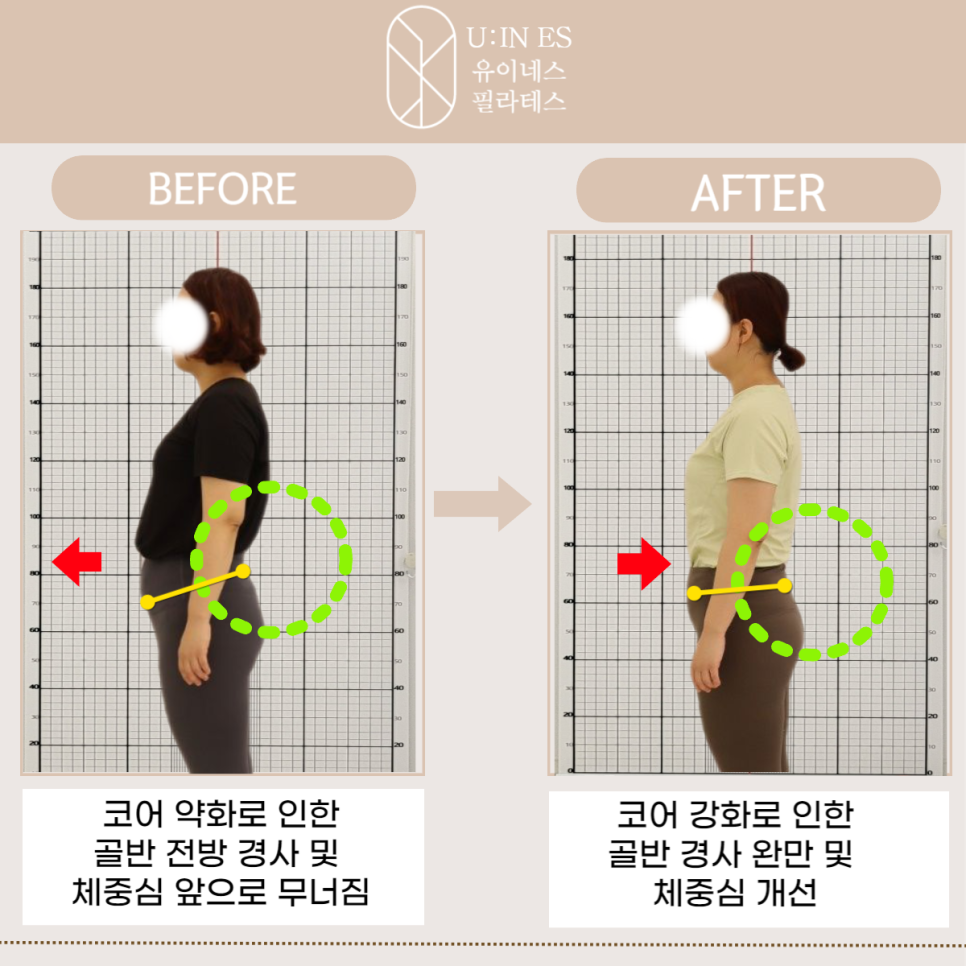 버닝포항 이미지
