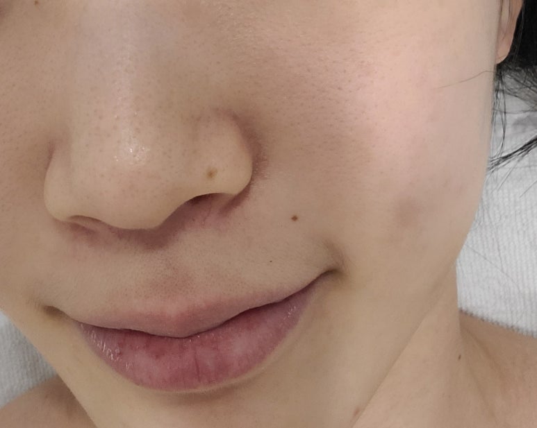 정원장의 모공세척테라피 이미지
