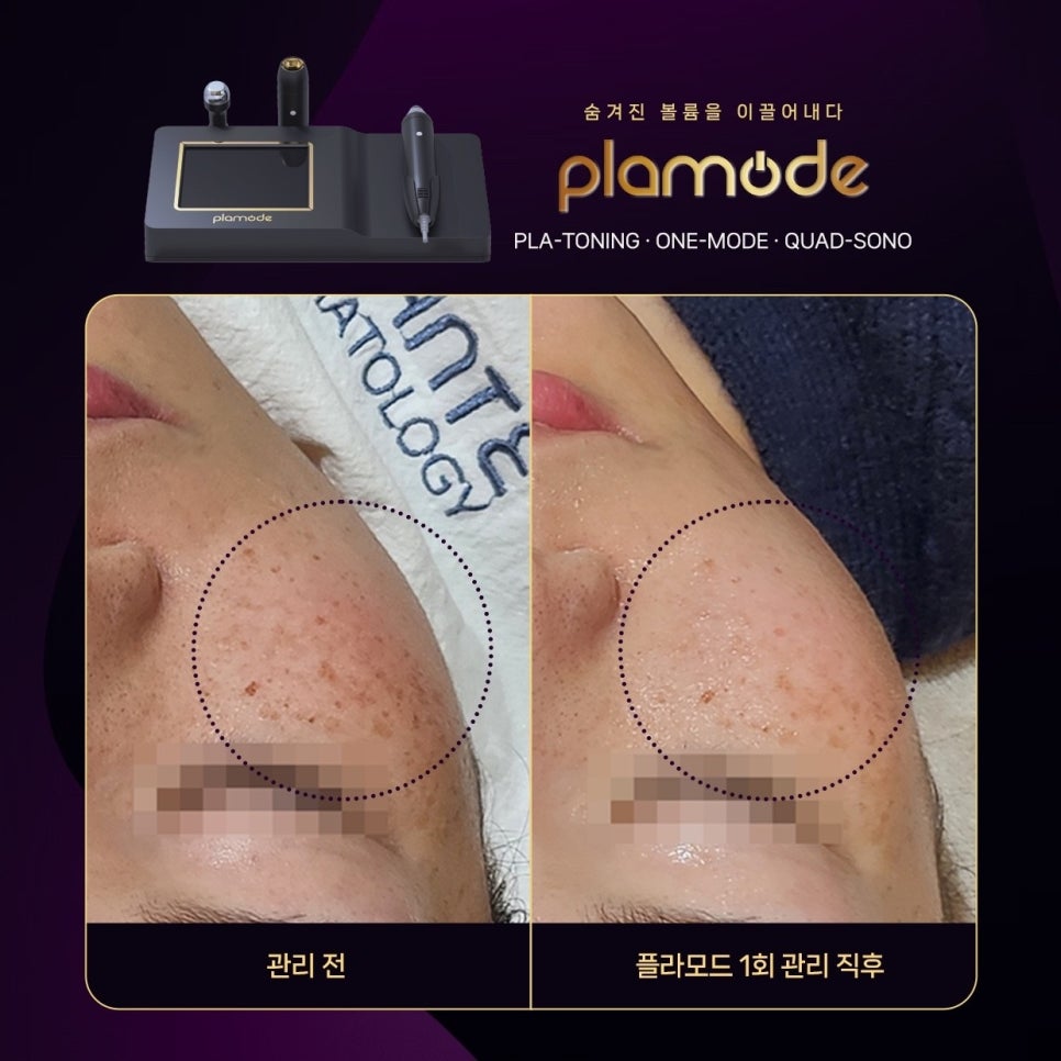 슬로우모드 이미지