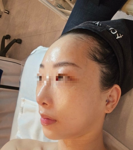 뷰티인시아 에스테틱 이미지