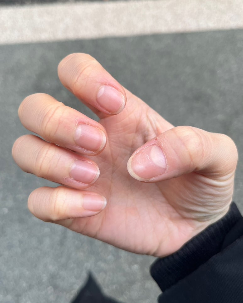 네일프릴 수유 이미지