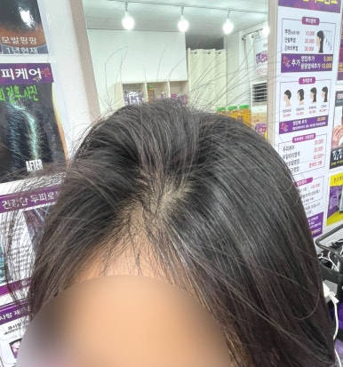 큐사랑구미형곡 이미지