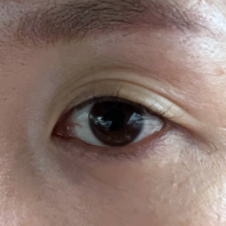 아이예뻐 (eye예뻐) 이미지