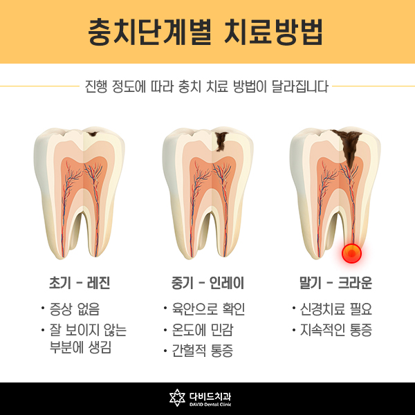 다비드치과 이미지