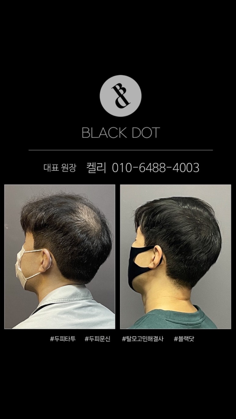 블랙닷 이미지