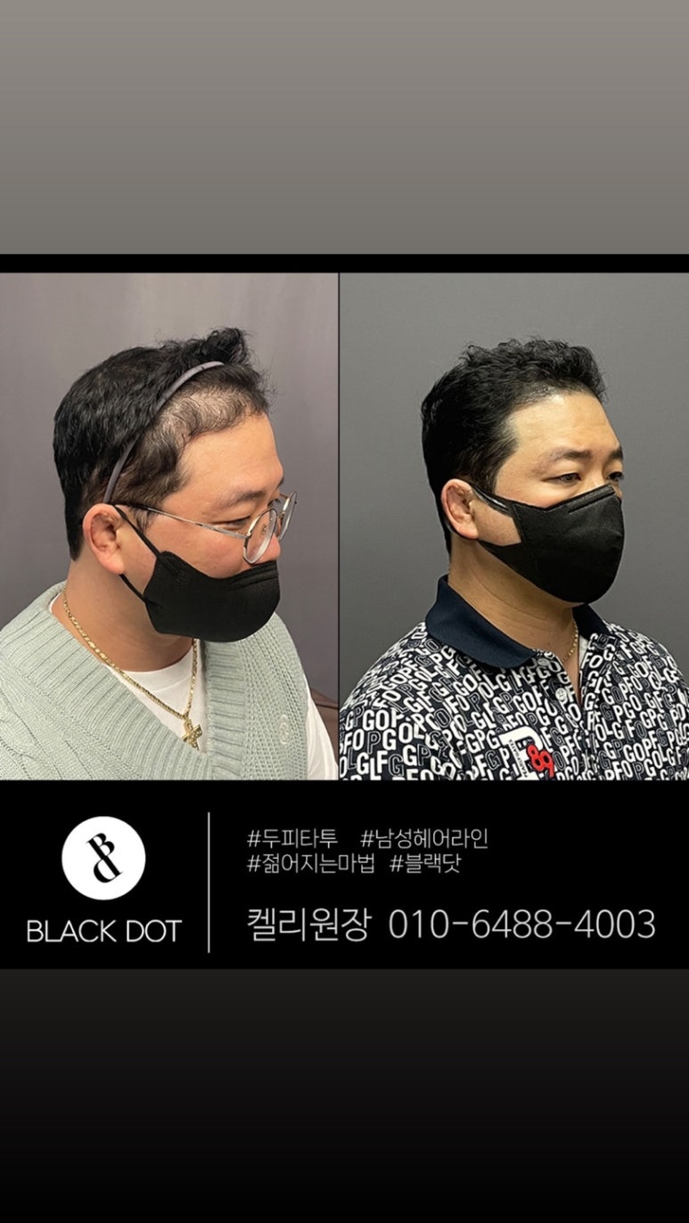 블랙닷 이미지