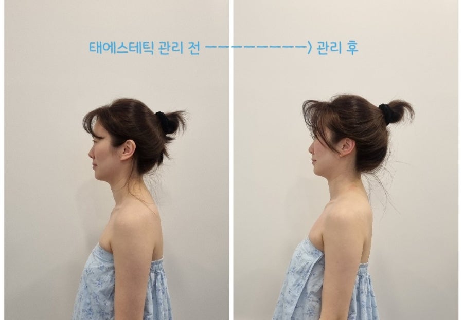 별체형관리 이미지