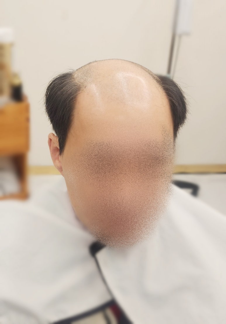 위그모아 이미지