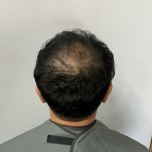 롱롱아이래쉬 이미지