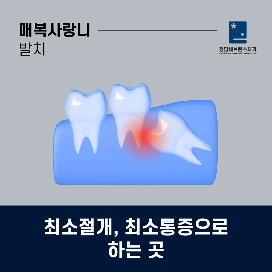 청담세브란스치과의원 이미지