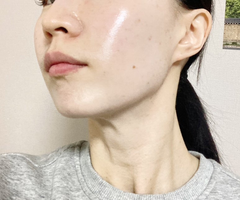 루즈에스테틱 이미지