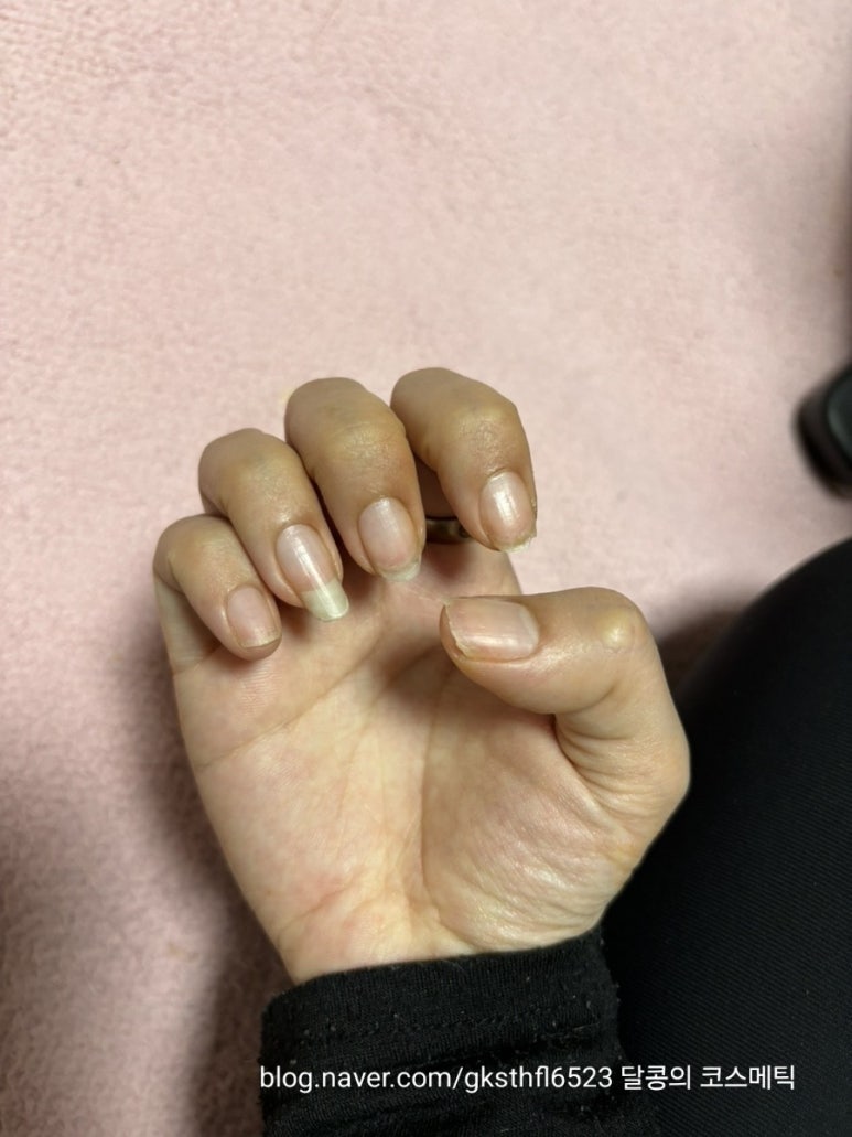 달콩네일 이미지