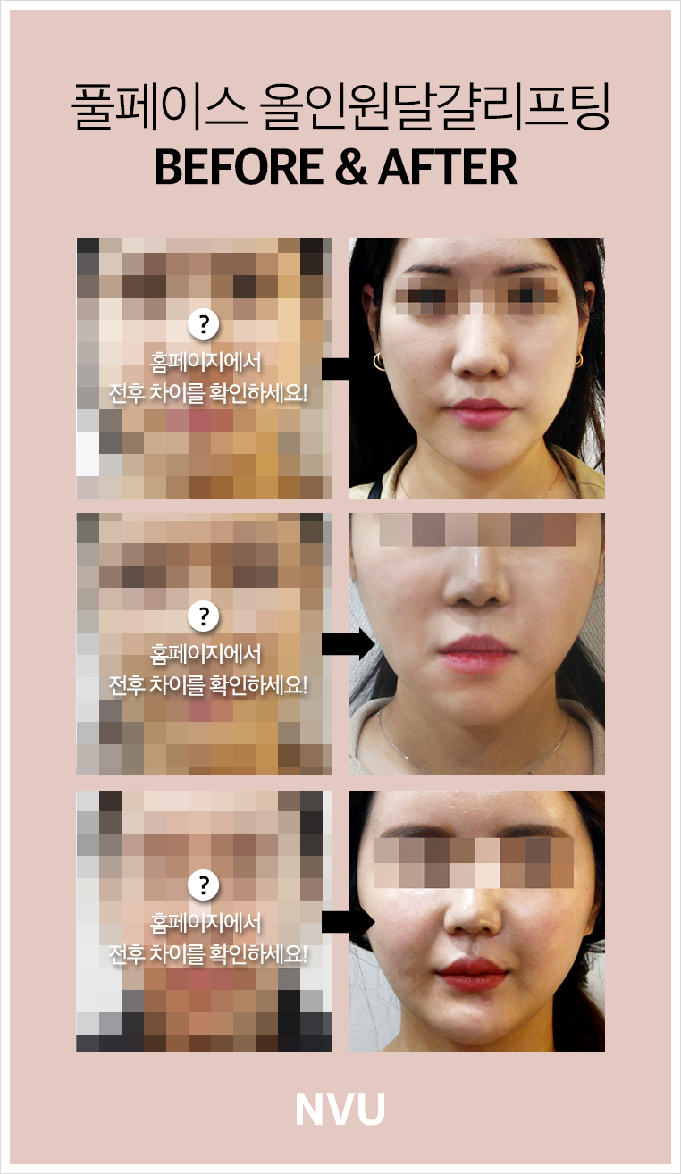 엔비유의원 이미지
