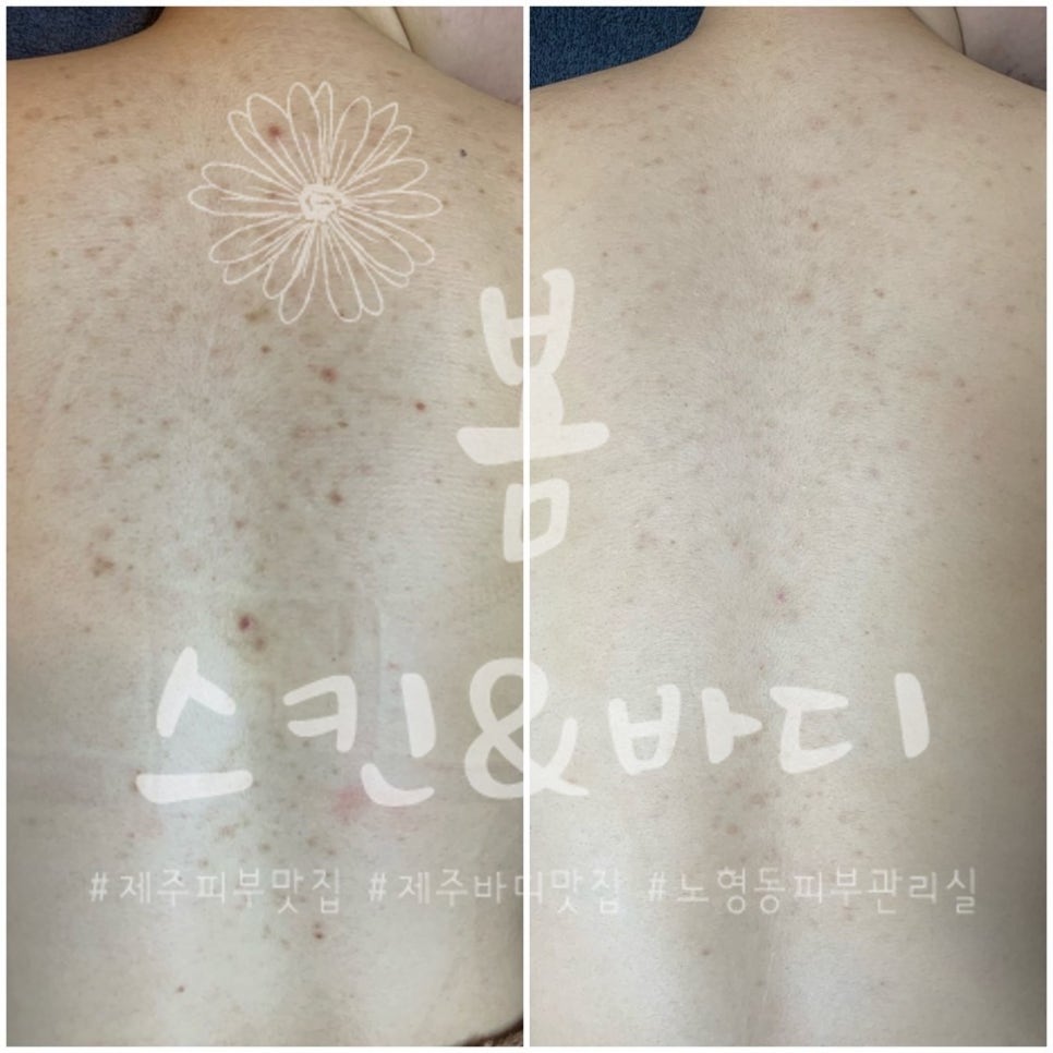 봄스킨앤바디 이미지