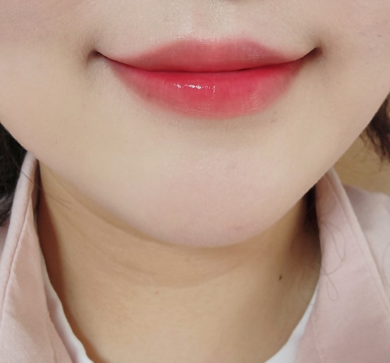 덴트천재 이미지