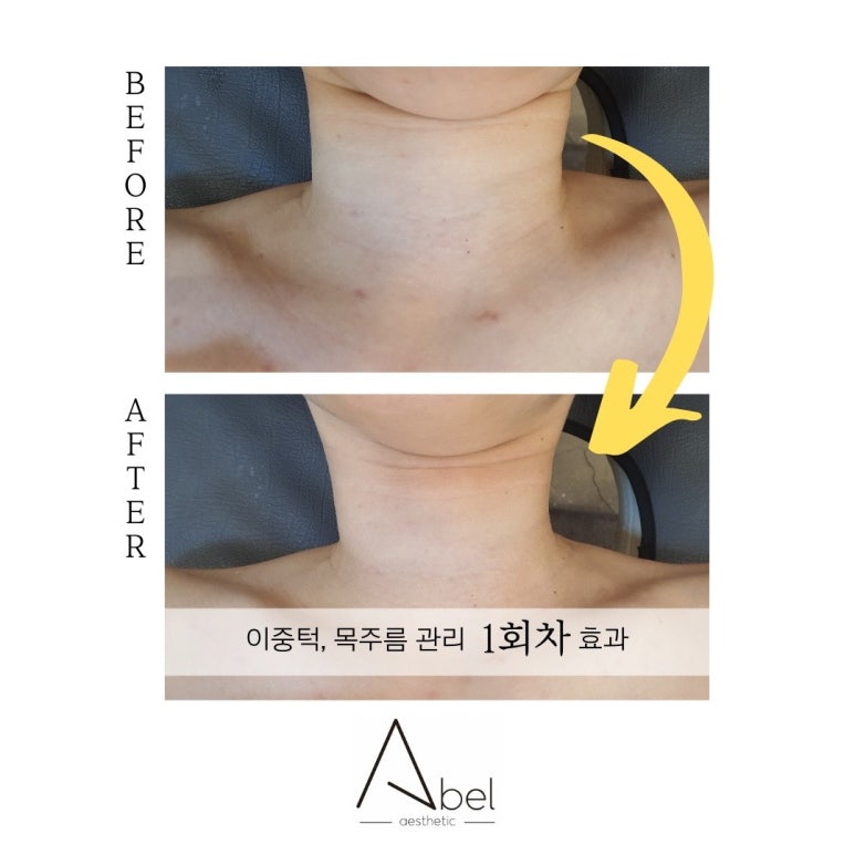 힐테라피 이미지