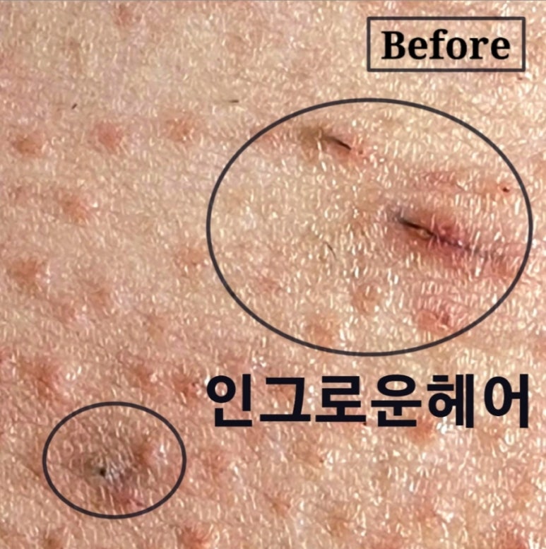 대구 바프&브라질리언 왁싱 데니샵 상인점 이미지
