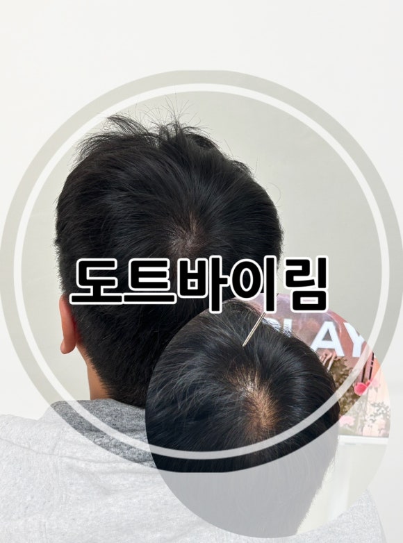 도트바이림 이미지