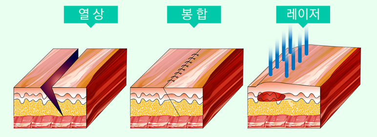 더노블강남삼성성형외과 이미지