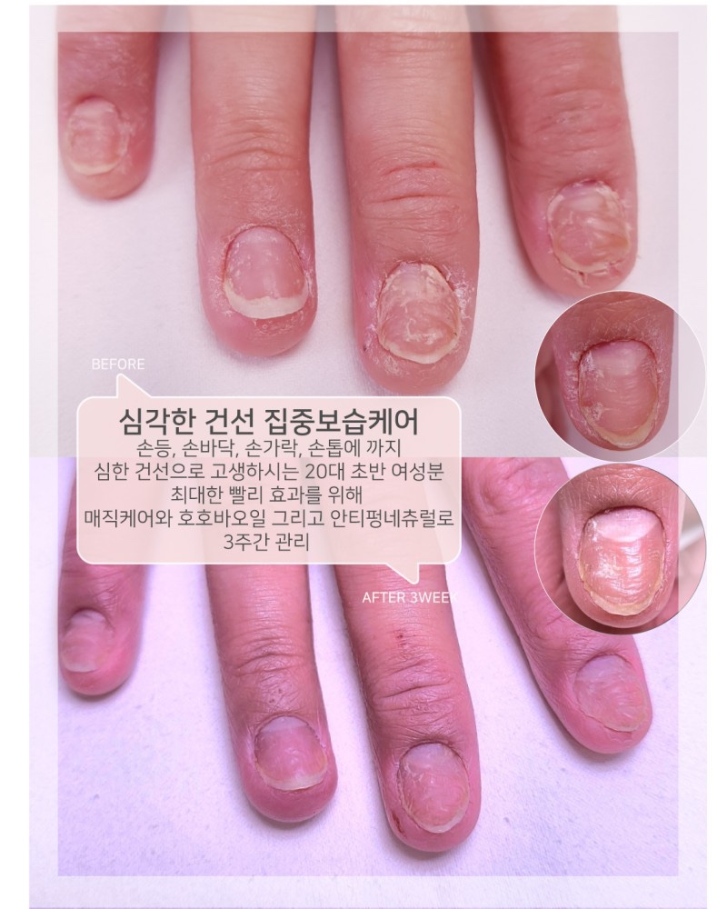 매직네일 이미지