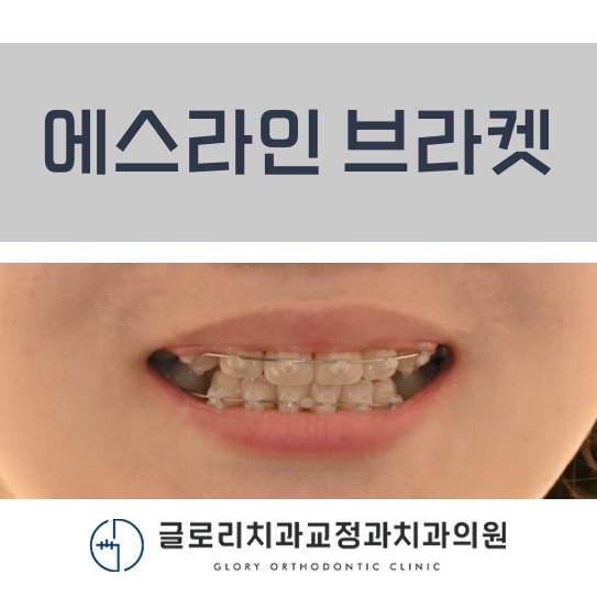 서울이라인치과교정과치과의원 이미지