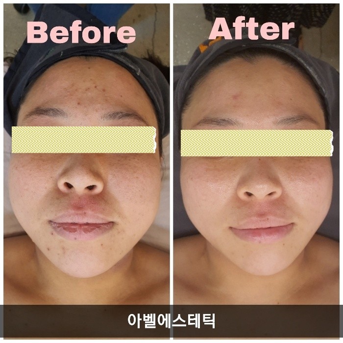 힐테라피 이미지