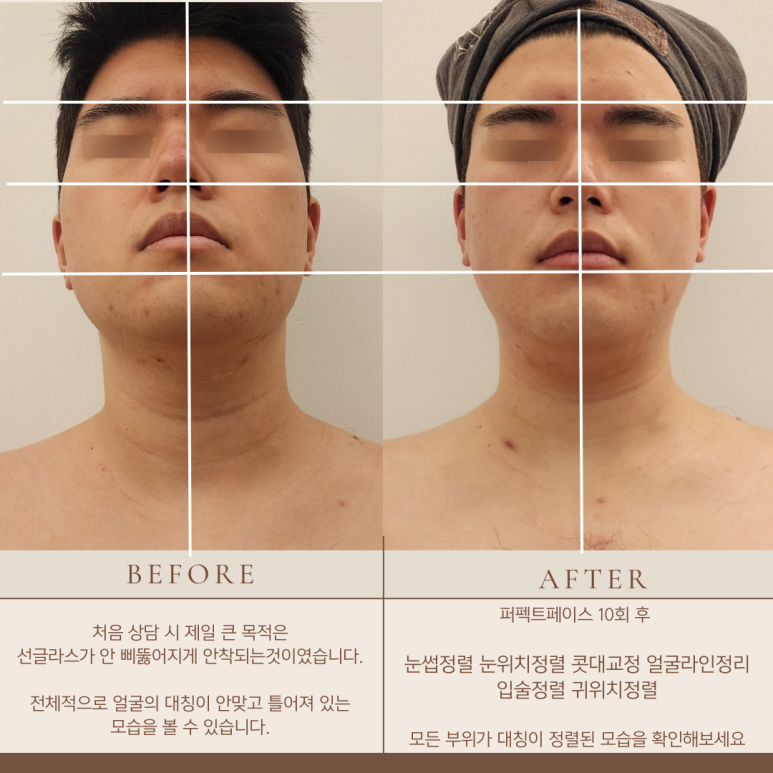 금손테라피 이미지