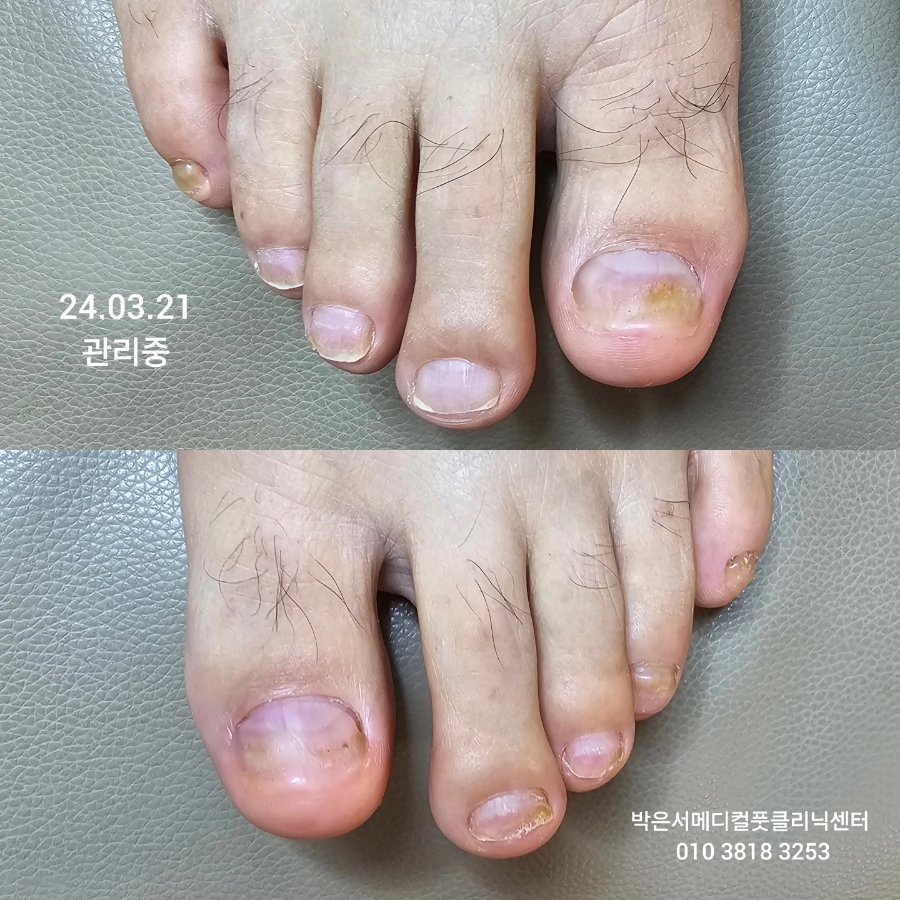 박은서메디컬풋클리닉센터 이미지