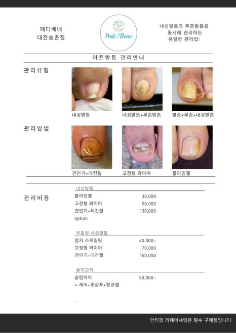 타임네일 이미지