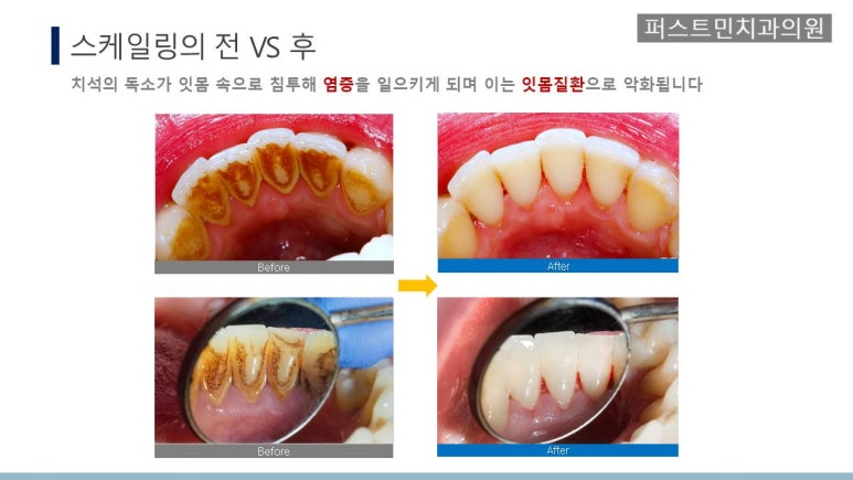 퍼스트민치과의원 이미지