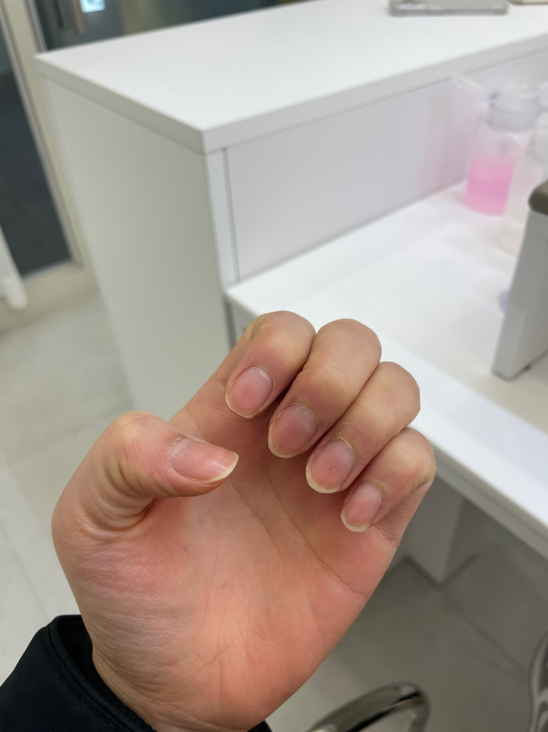 피넛네일 이미지