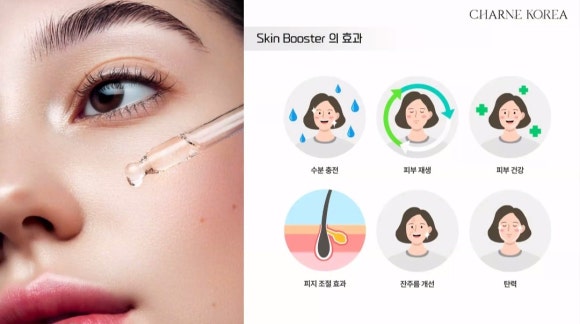 샤르네 이미지