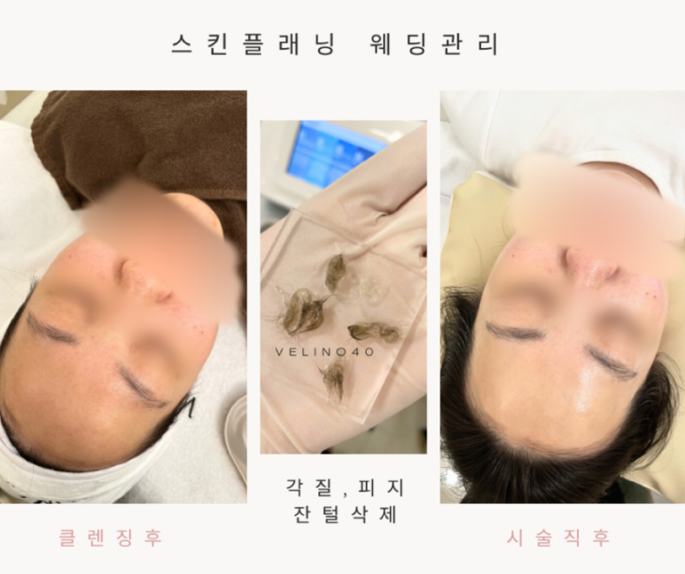 벨리노에스테틱 이미지