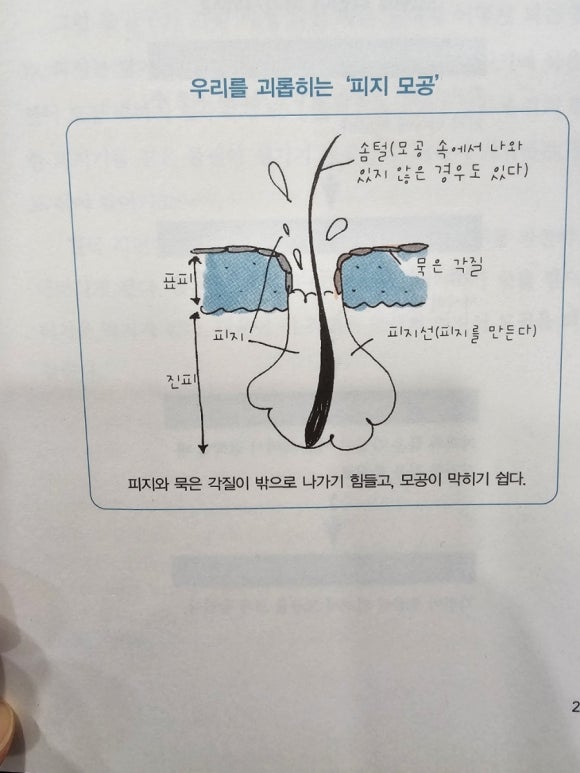 양산 여드름 관리 남부동 피지 모공 재생관리 잘하는 곳 '여드름살롱'