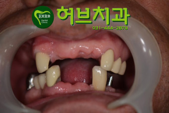 세계광택 이미지