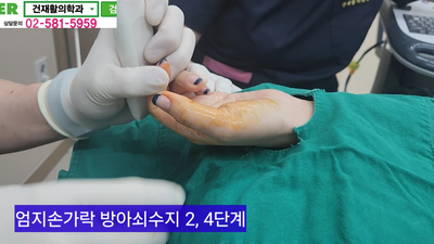 수지2 이미지