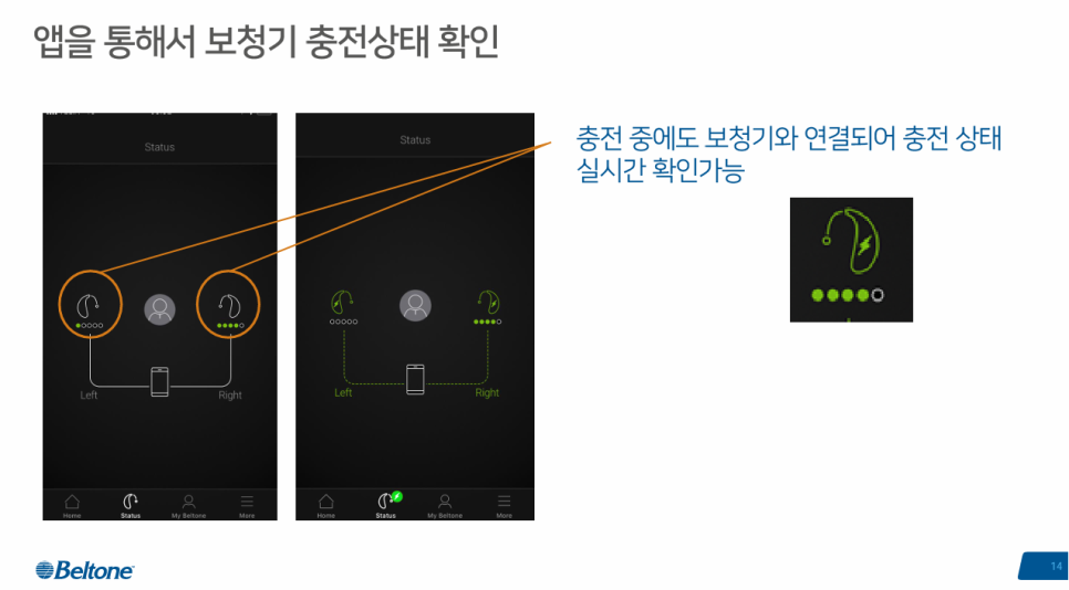 독일 베스트 보청기 이미지