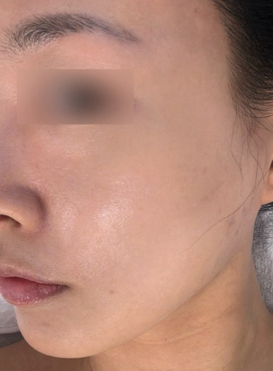 뷰티인시아 에스테틱 이미지