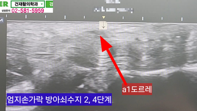 수지2 이미지