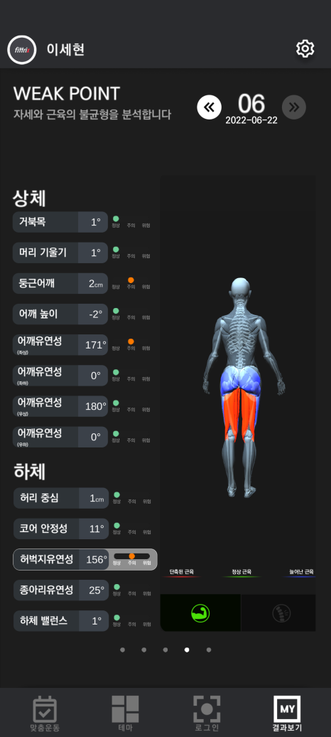 피트릭스 이미지