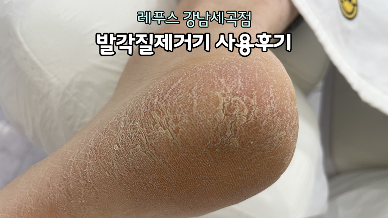 레푸스강남세곡점 이미지