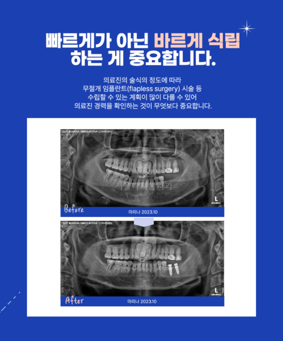 서울다시봄치과 이미지